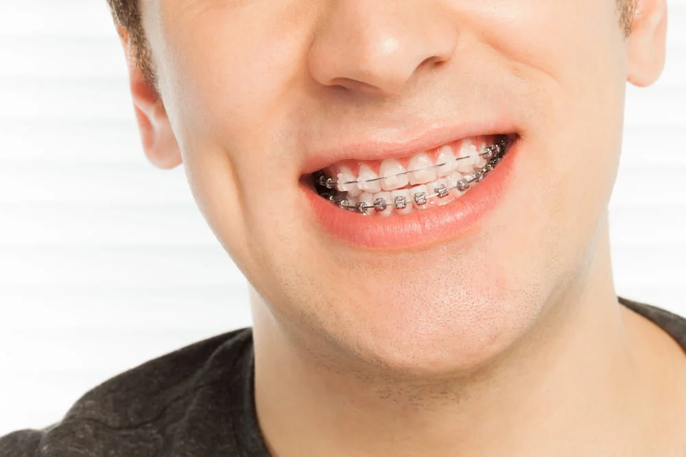 Bethesda MD Dentist