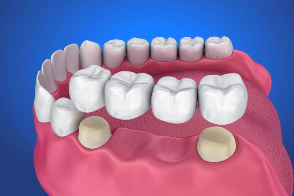 Bethesda Dentist