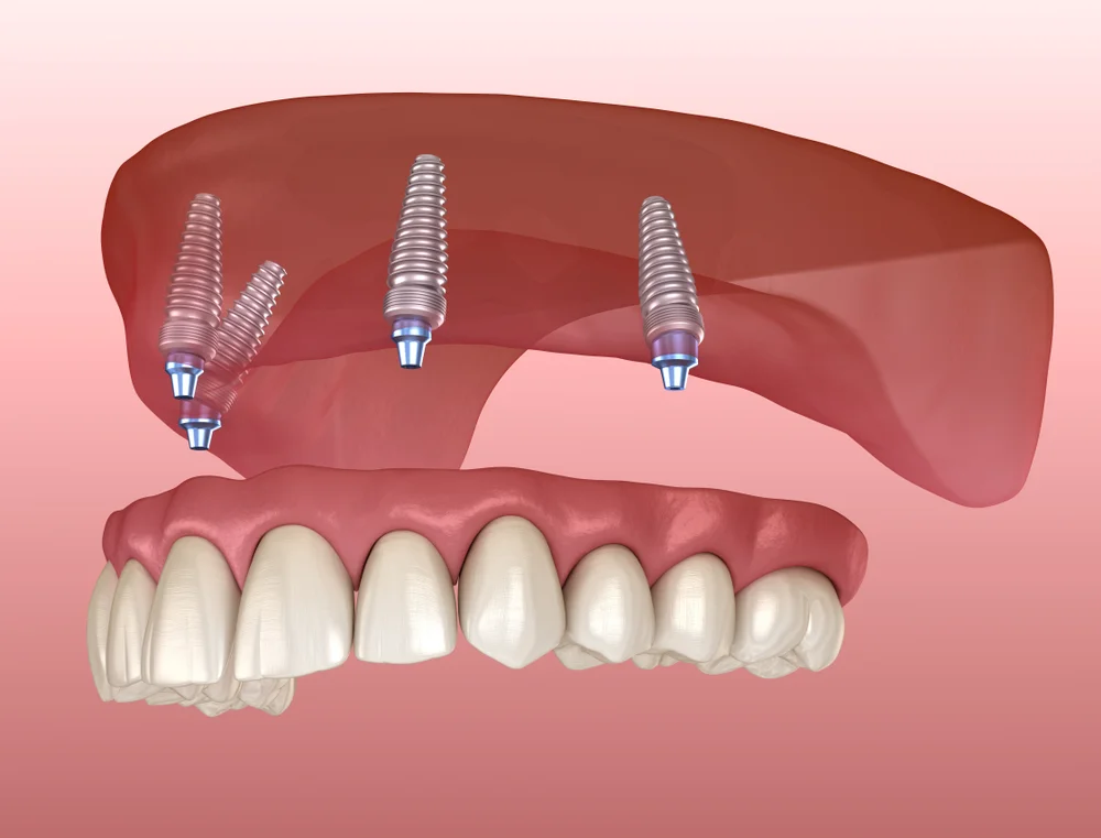 Dentist 20817