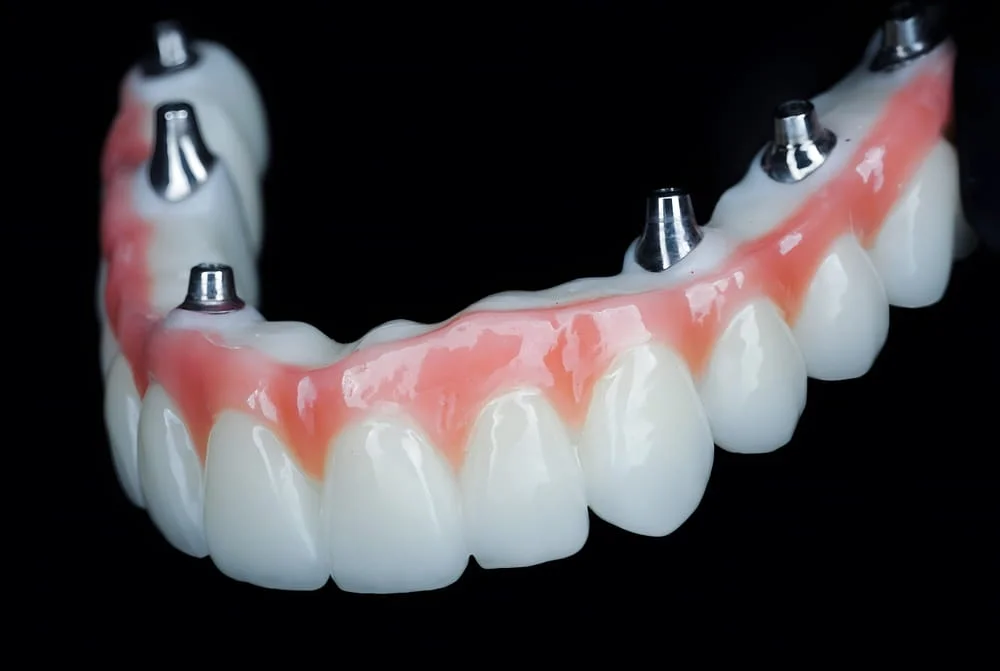 Dentist Bethesda