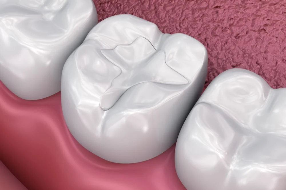 Best Dentist Bethesda