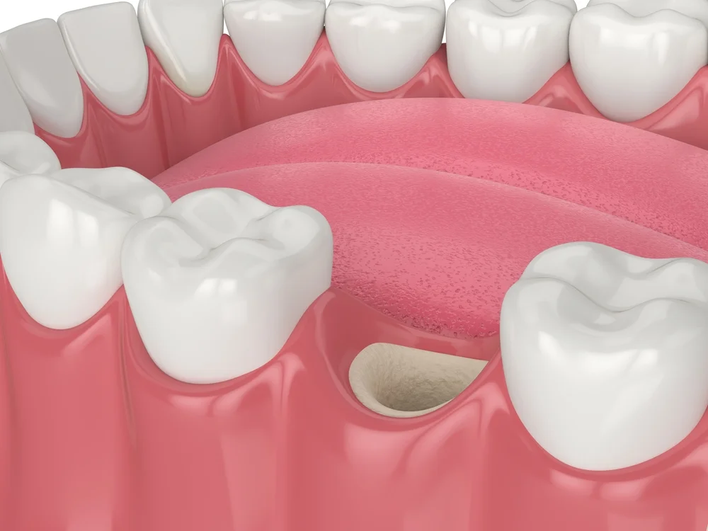 Dentist Near Me