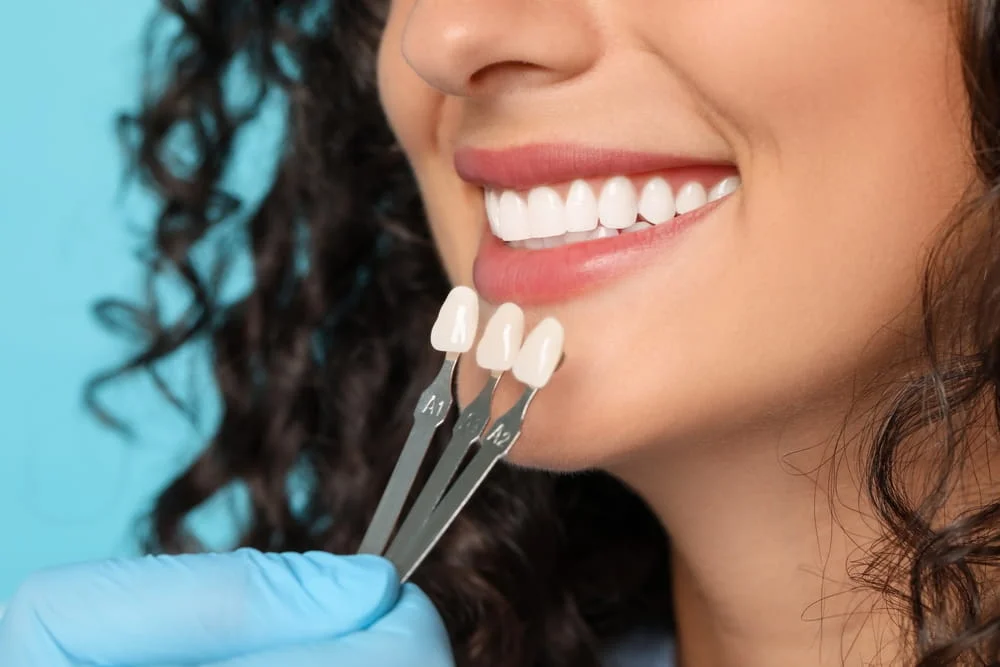 Bethesda Dentist