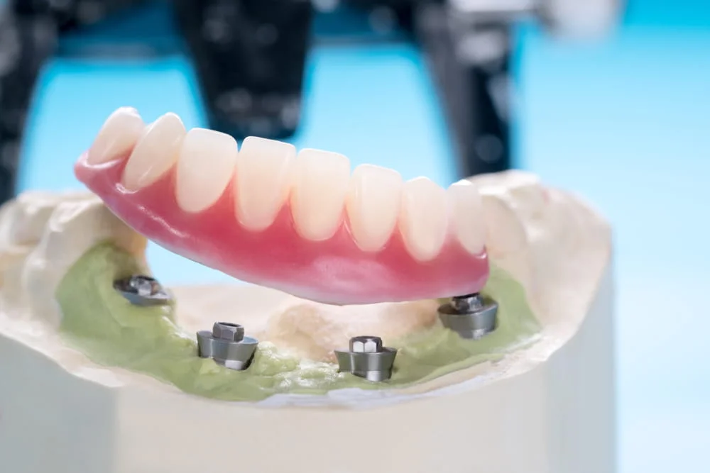 Bethesda MD Dentist
