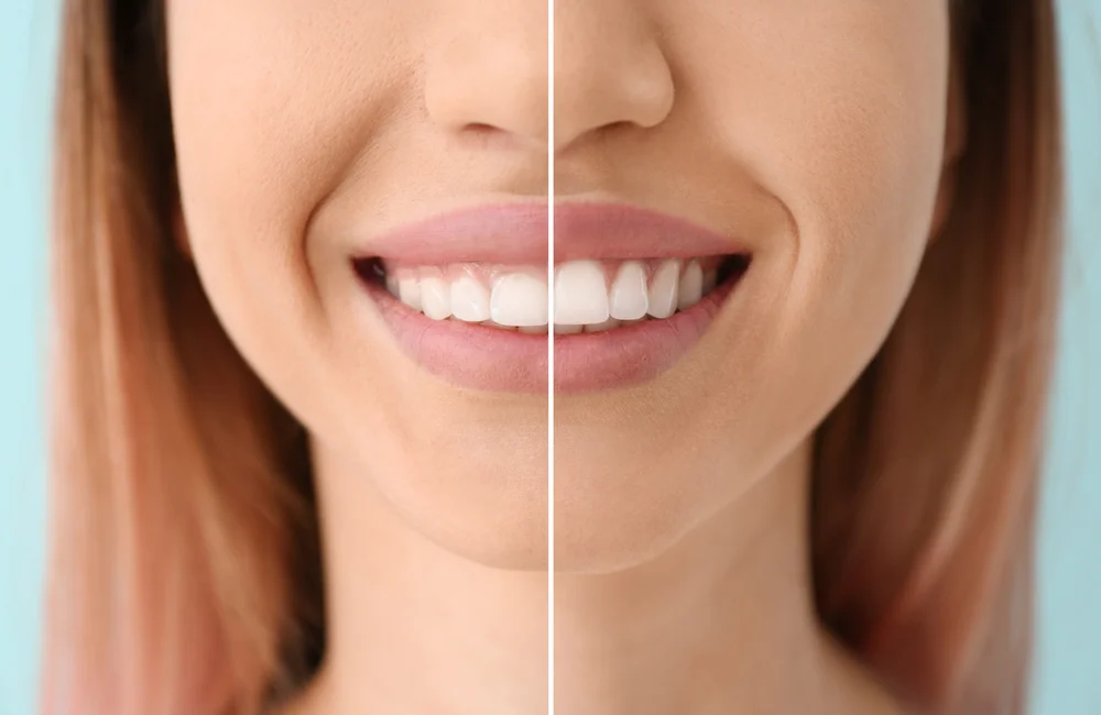 Bethesda Dentist