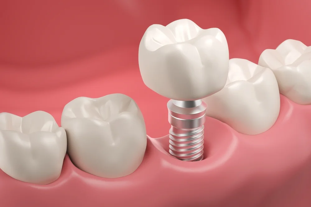Bethesda MD Dentist